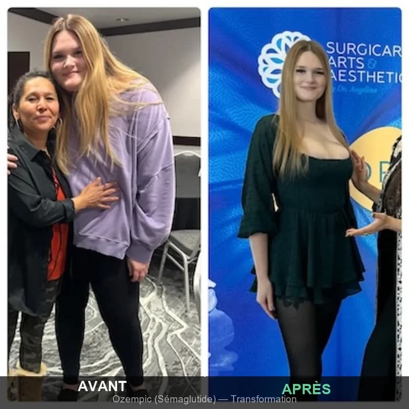 Illustration — Ozempic Naturel — Alternatives et Molécules Similaires