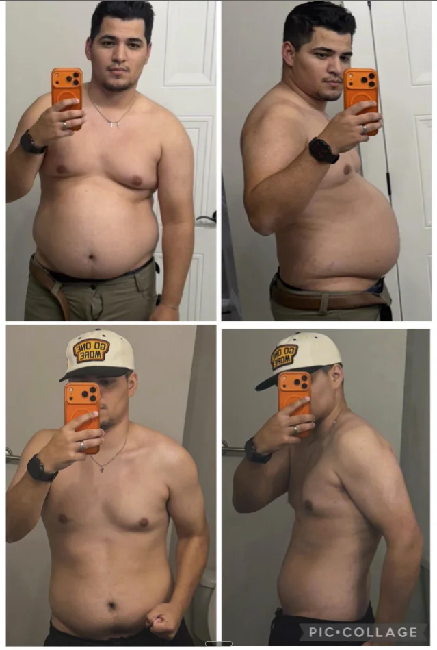 Retatrutide avant après — transformation complète face et profil, perte de graisse abdominale significative